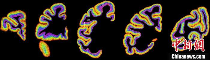 アカゲザルの脳における異なる種類の細胞の分布狀況。畫像提供は中國科學院脳科學?スマート技術卓越イノベーションセンター